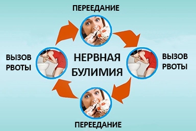 Лечение булимии в Ясногорске
